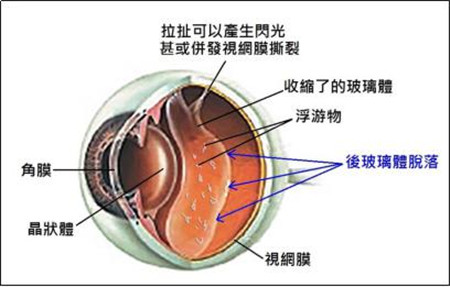 玻璃体视网膜