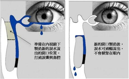 眼眶病,希玛瑞视眼科,上海眼科医院