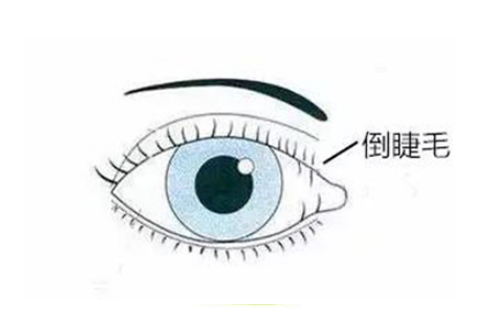 眼表眼角膜