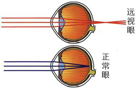 小儿眼病