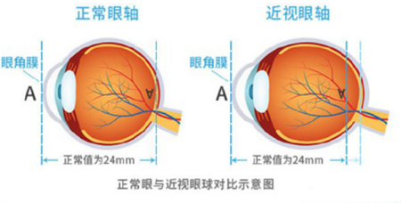 小儿眼病,希玛瑞视眼科,上海眼科医院