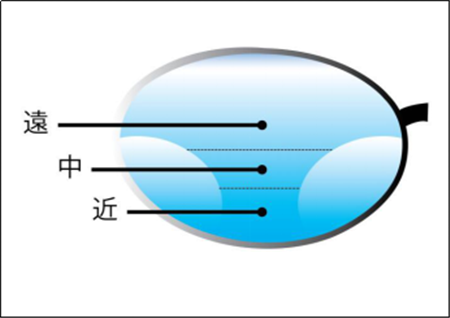 屈光矫视