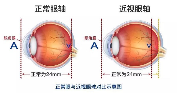 玻璃体视网膜