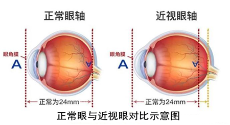 玻璃体视网膜