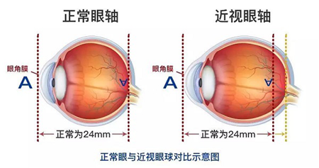 玻璃体视网膜