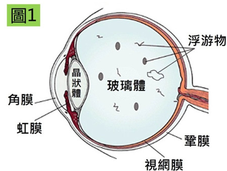 玻璃体视网膜