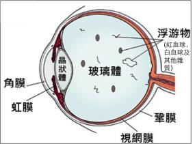 玻璃体视网膜