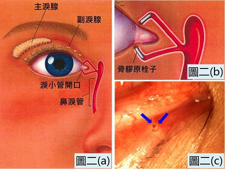 眼表眼角膜