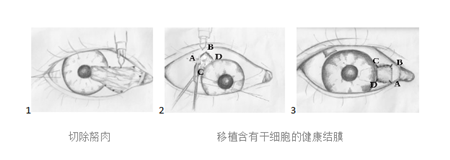 眼表眼角膜