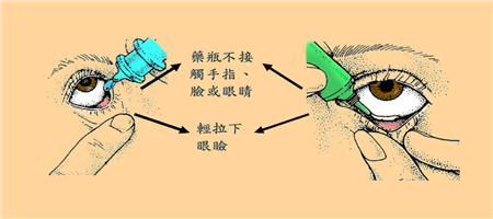 眼表眼角膜