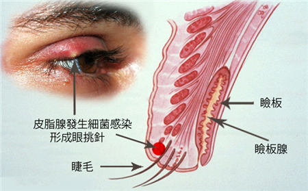 眼表眼角膜