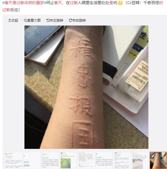 眼表眼角膜