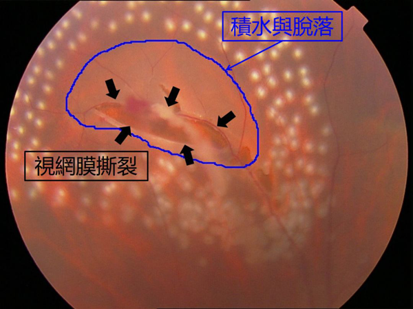 玻璃体视网膜,希玛瑞视眼科,上海眼科医院