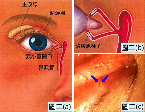 眼表眼角膜