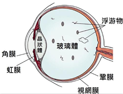 玻璃体视网膜