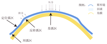 医学验光配镜