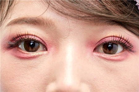 屈光矫视,希玛瑞视眼科,上海眼科医院
